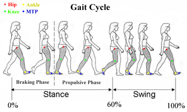 Gait cycle case study picture